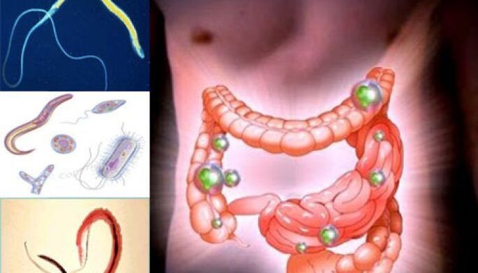 paraziți în intestinul uman